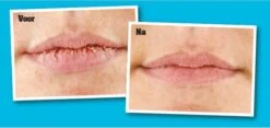 O'Keeffe's Lip Repair Verkoelend -Cosmetica Promotiewinkel 1200x568 1